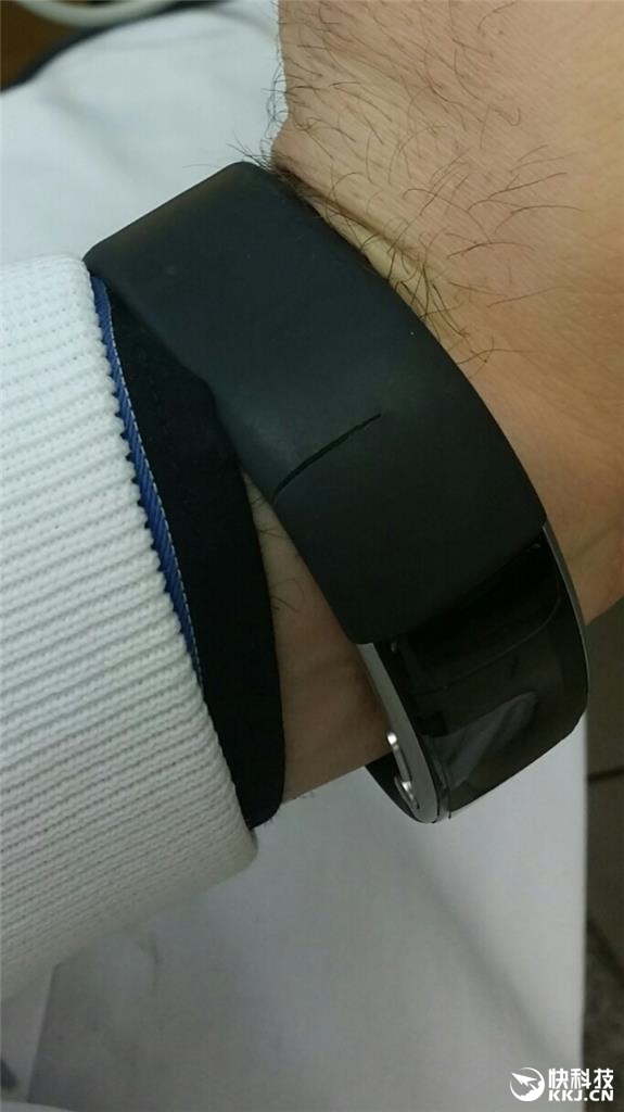 触目惊心！微软手环2腕带大量开裂
